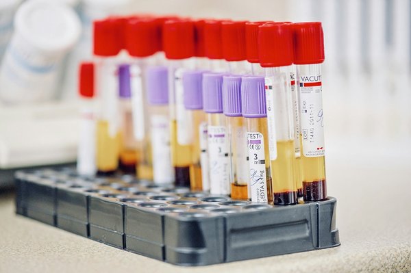 Dépistage précoce de la grossesse : les tests sanguins